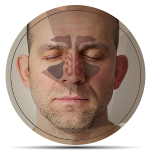 clinica-orl-cirurgia-de-nariz-sinusectomia